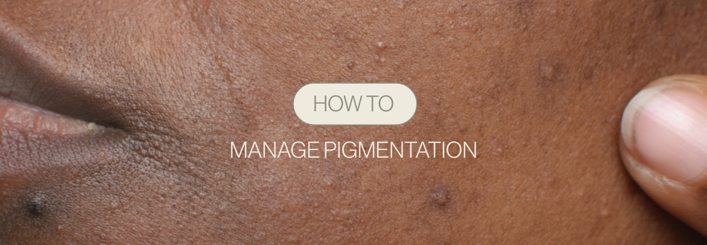 Pigmentation