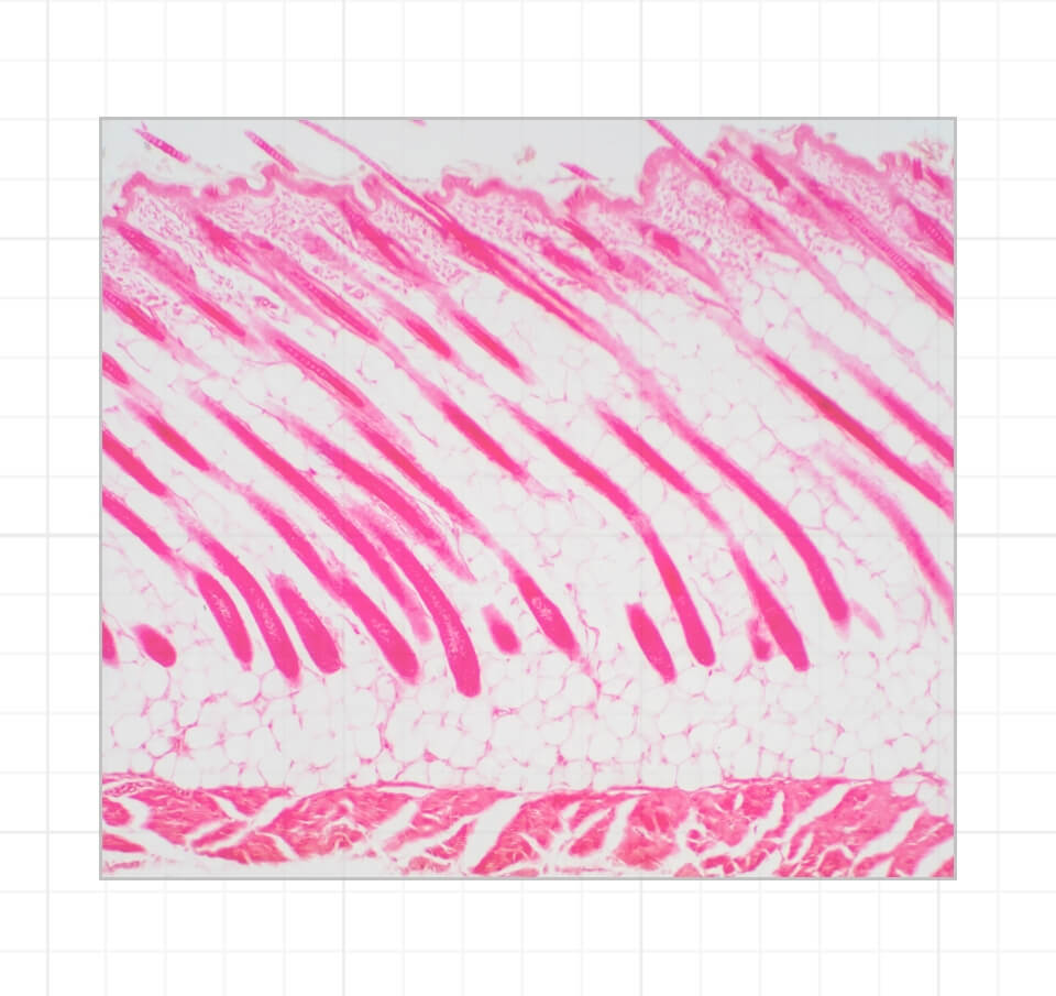 collagen formation in skin